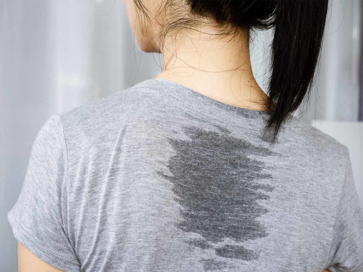 Excessive Sweating